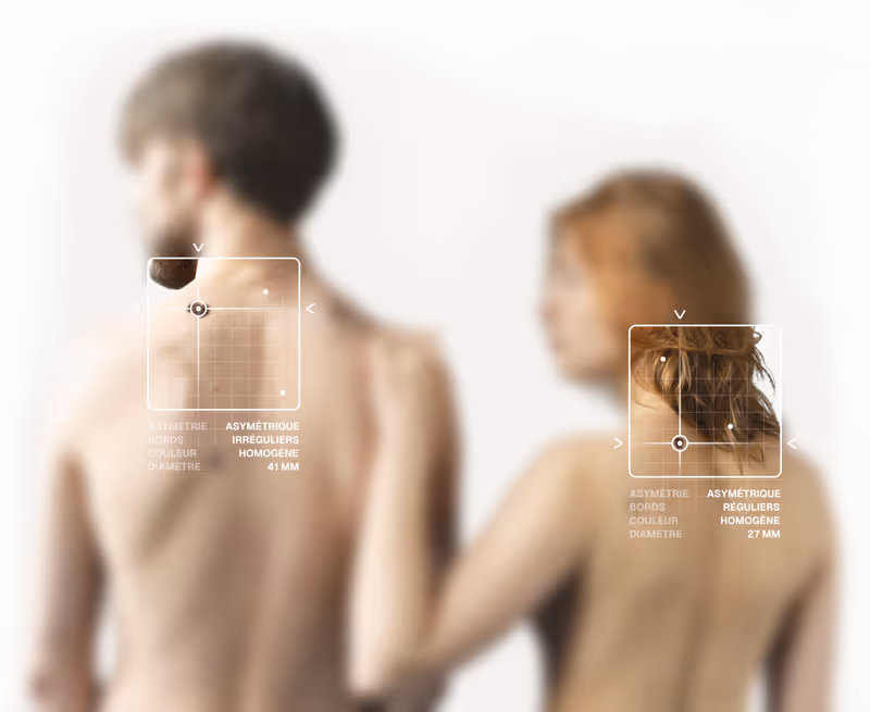 Patients DermaScan